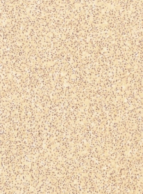 textured formica